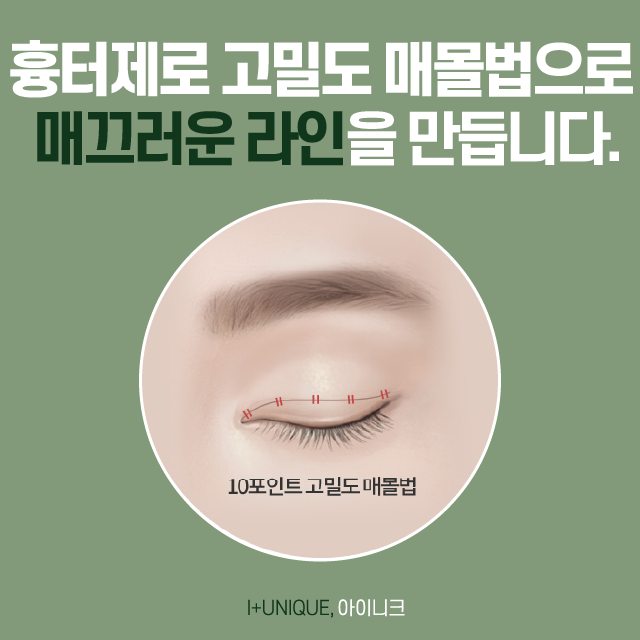 흑역사 없는 졸업사진 찍는 법? 아이니크의 눈쌍꺼풀수술! 관련 이미지 3