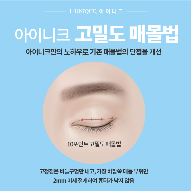 쌍꺼풀수술잘하는병원은 역시 아이니크성형외과 관련 이미지 4