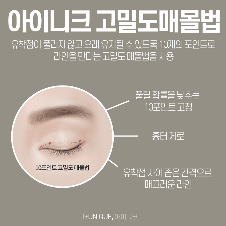 자연스러운쌍꺼풀을 원한다면 아이니크성형외과에서 이것만 확인하자 관련 이미지 5