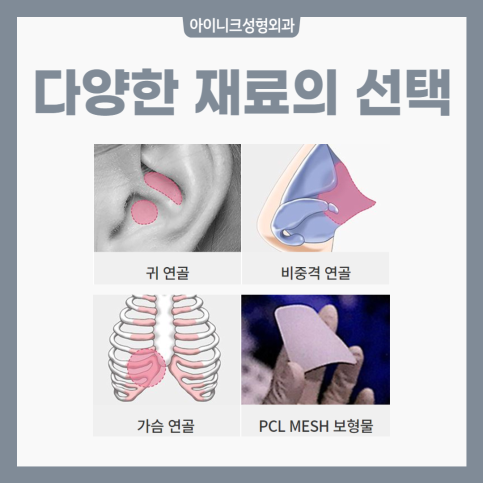 코끝시술 처짐 없는 매끈한 라인 관련 이미지 4