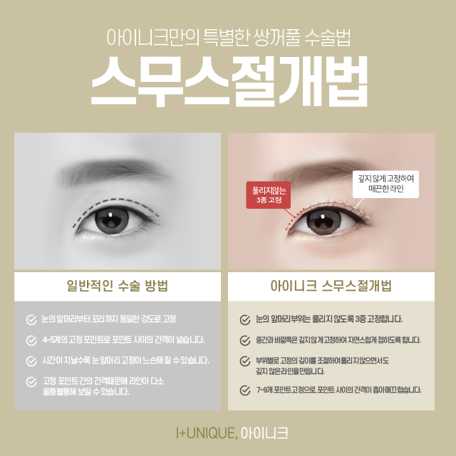 Types of Double Eyelid Surgery: Which Design Suits My Eyes? image 3