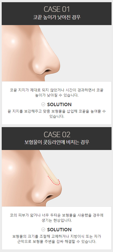 늑연골코재수술 안전한 보형물로 자연스럽게! 관련 이미지 3