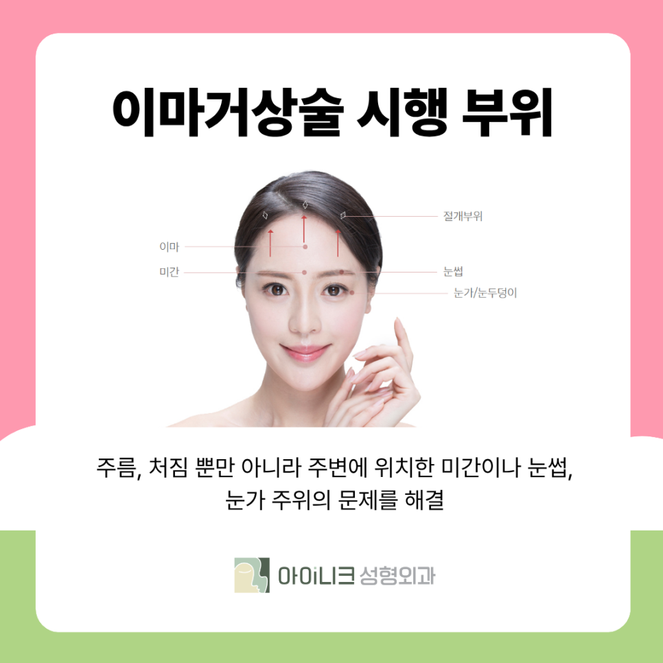 How Endoscopic Forehead Lift Surgery Is Performed and Its Expected Effects image 5