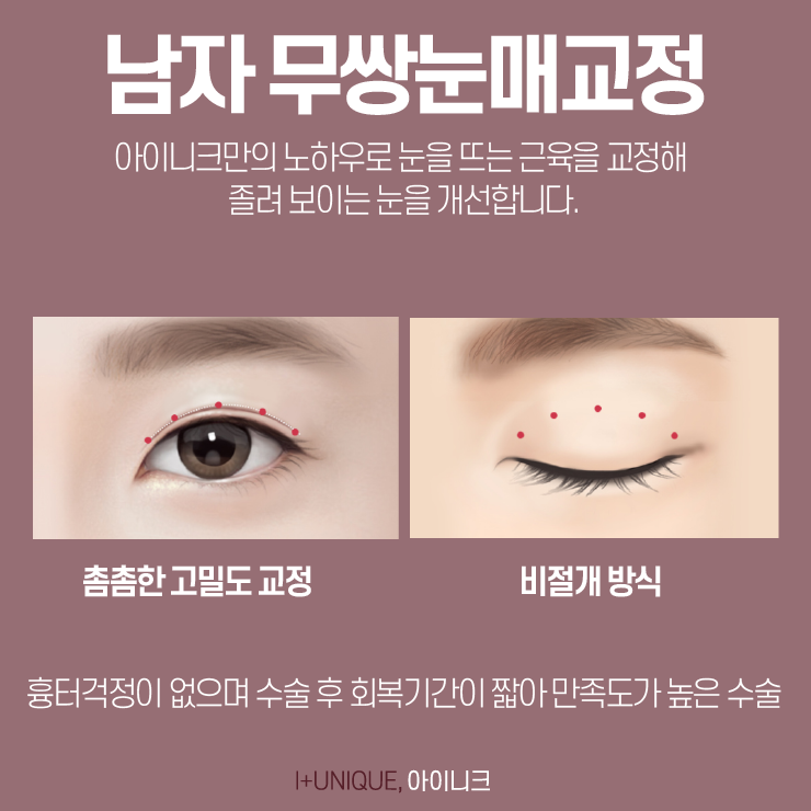 남자쌍꺼풀수술에 대해 알고싶다면, 아이니크성형외과를 주목하자 관련 이미지 2