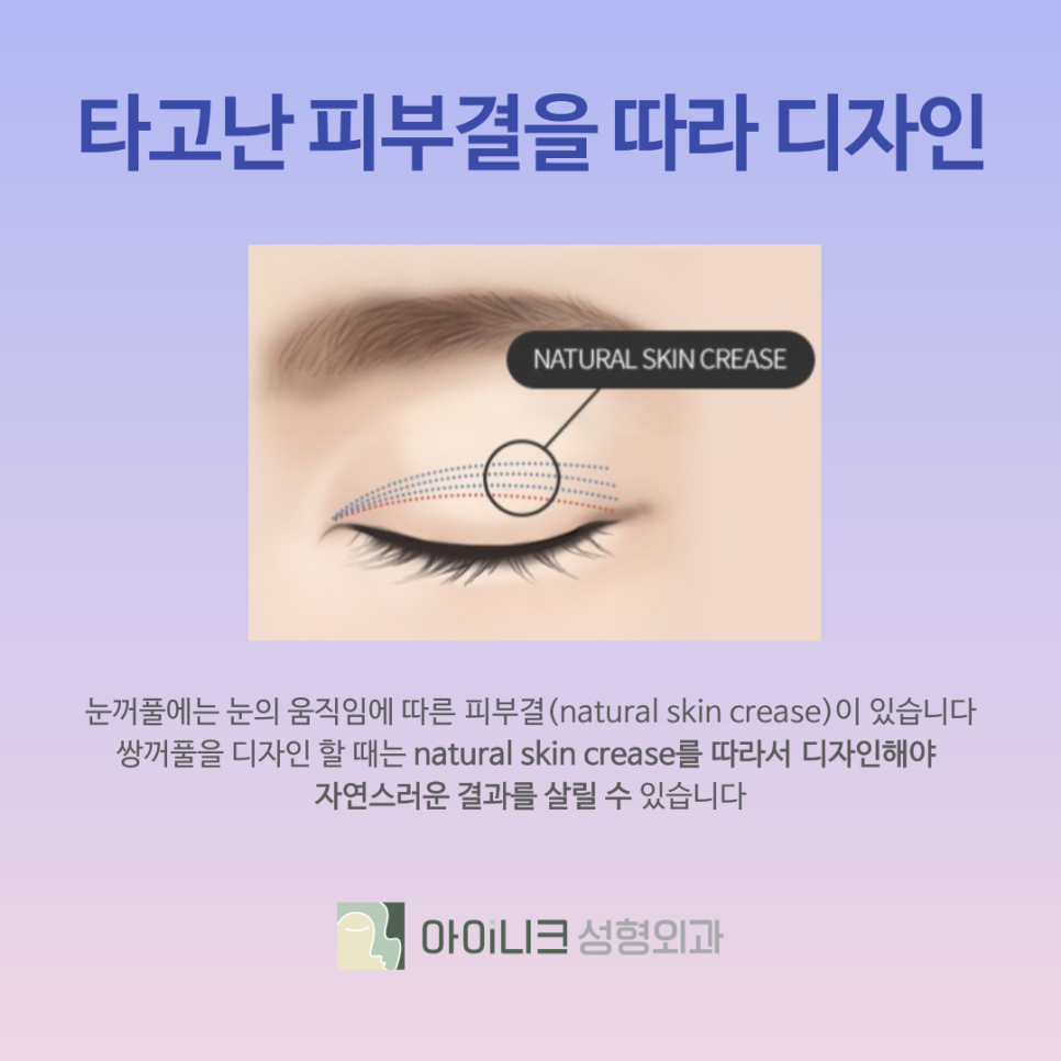 서울 쌍수 잘하는 곳 첫 수술 실패하지 않으려면 관련 이미지 7