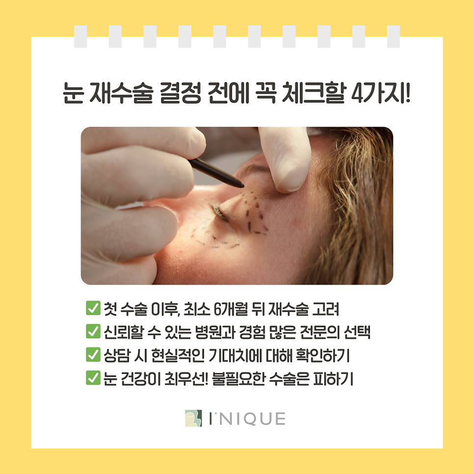 압구정 눈재수술 결정하기 전 꼭 체크할 네가지! 관련 이미지 4