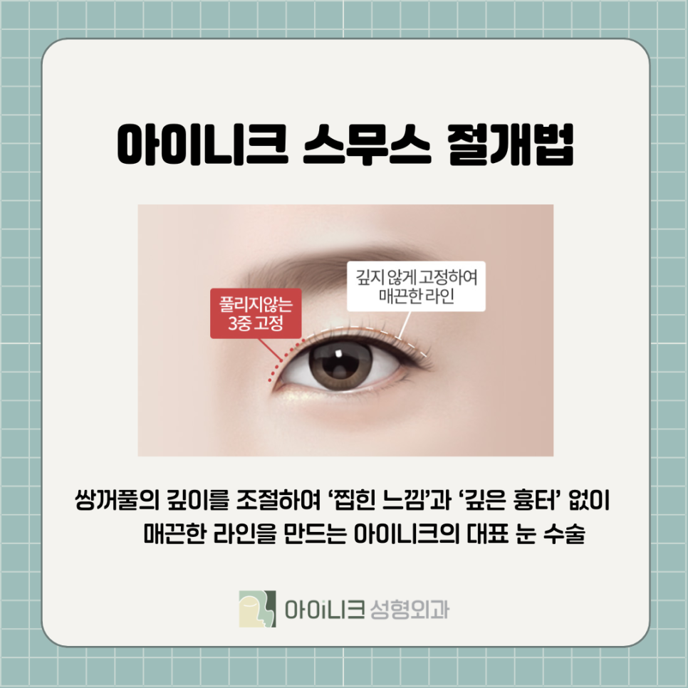 강남눈성형 자연스럽게 하려면 관련 이미지 6