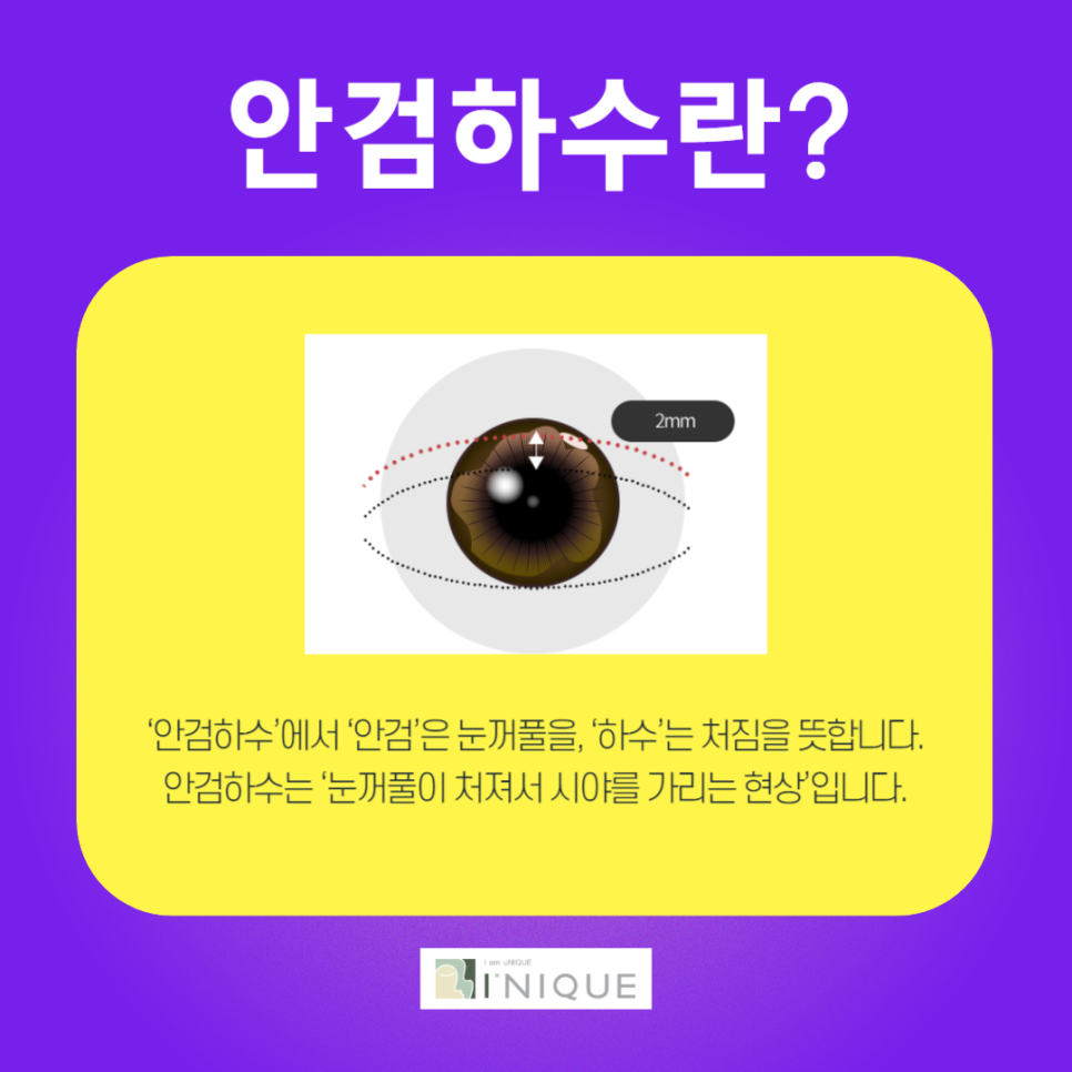 Drooping Eyelids, Starting from the Root Cause image 2