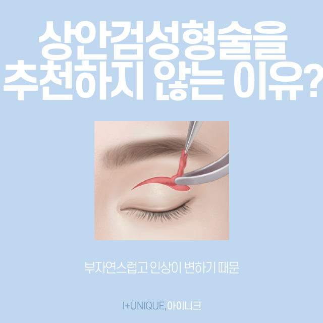 중년 눈 성형, 상안검성형술을 추천하지 않는 이유는? 관련 이미지 2