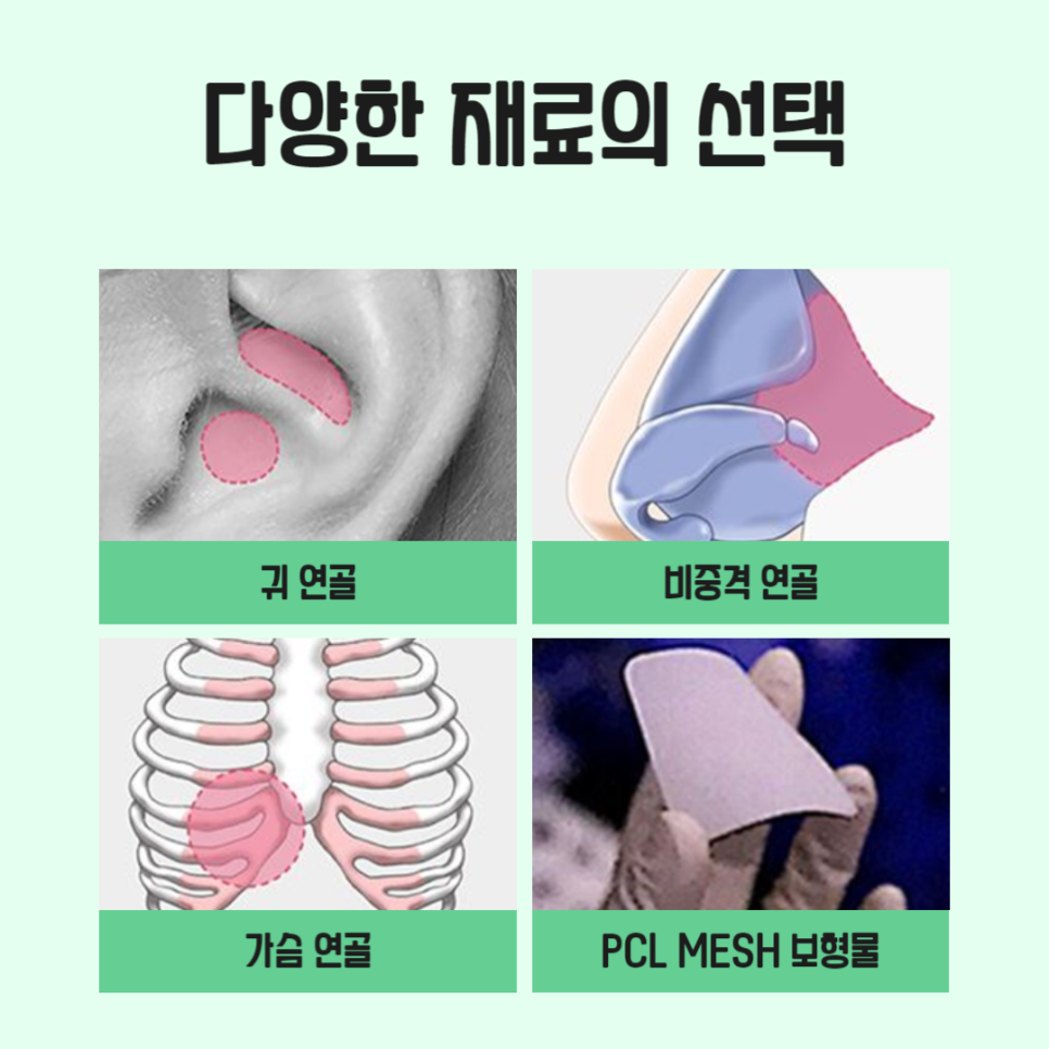 코재수술비용보다 중요한 것은 병원선택 관련 이미지 5