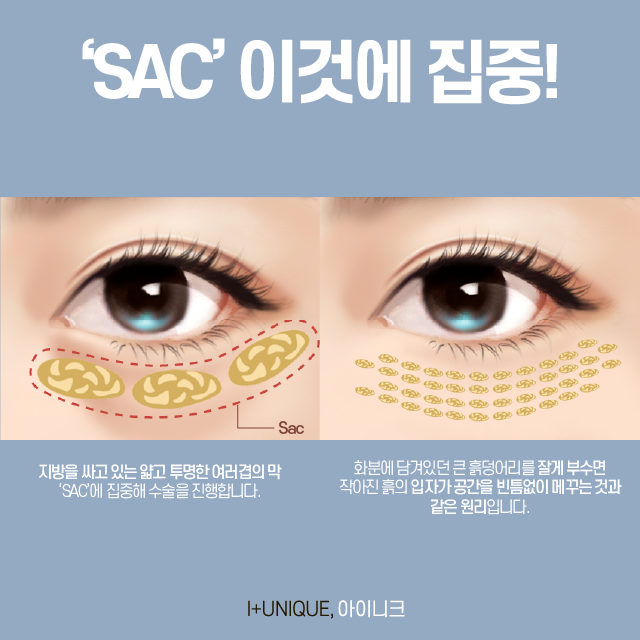 눈밑지방재배치 실패했다면? 이것이 답이다 관련 이미지 2