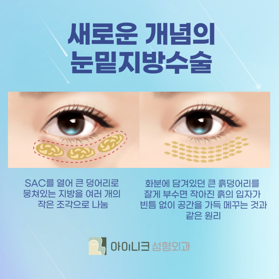Brighten Your Face Without Dark Circles with Lower Eyelid Surgery! image 4