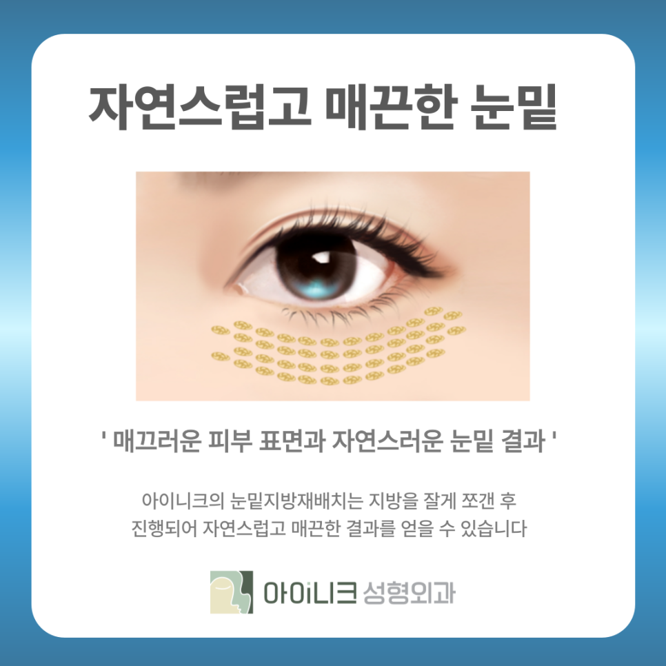 눈밑지방재배치수술잘하는곳 어둡고 칙칙한 얼굴 이제 그만 관련 이미지 9