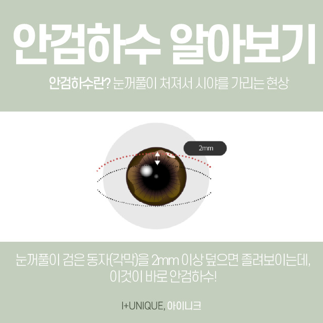 내 눈을 보다 또렷하게 ! 안검하수병원추천 관련 이미지 2