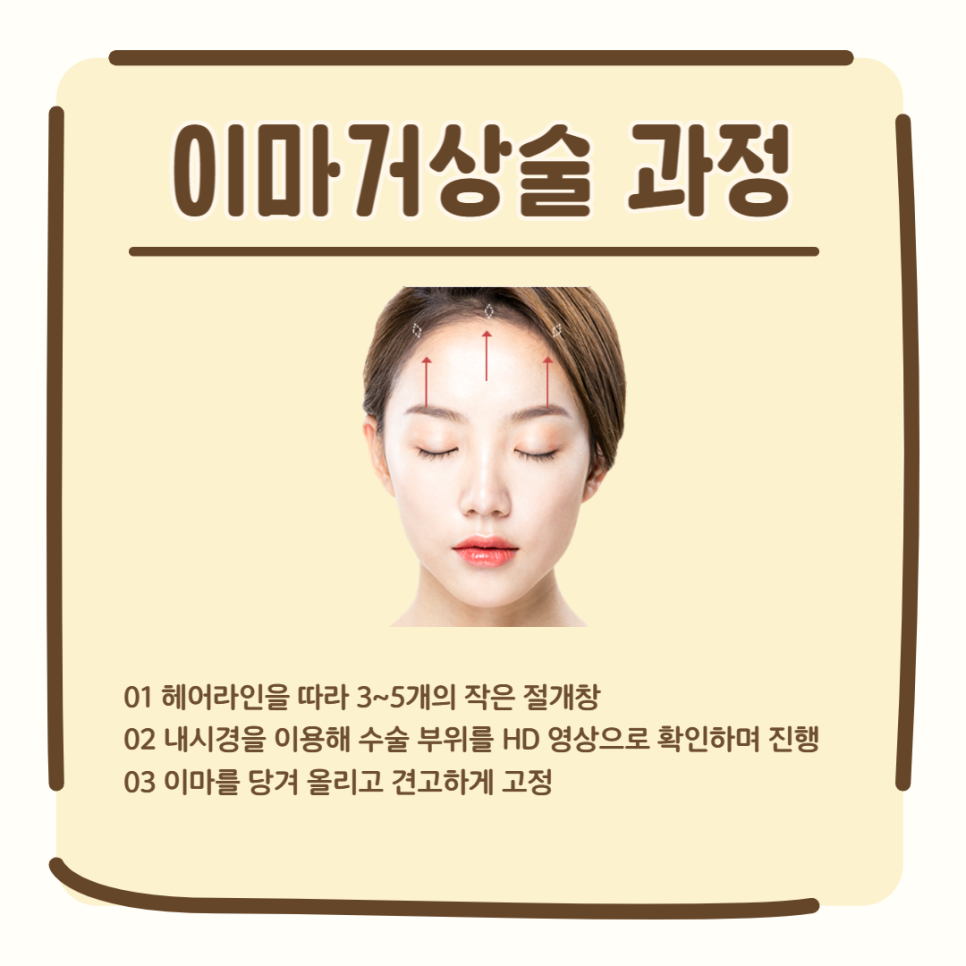 이마거상유명한곳, 이것이 달라요! 관련 이미지 3