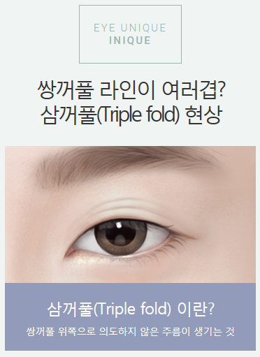 쌍커풀여러겹이 생겨 고민이라면 아이니크로! 관련 이미지 2