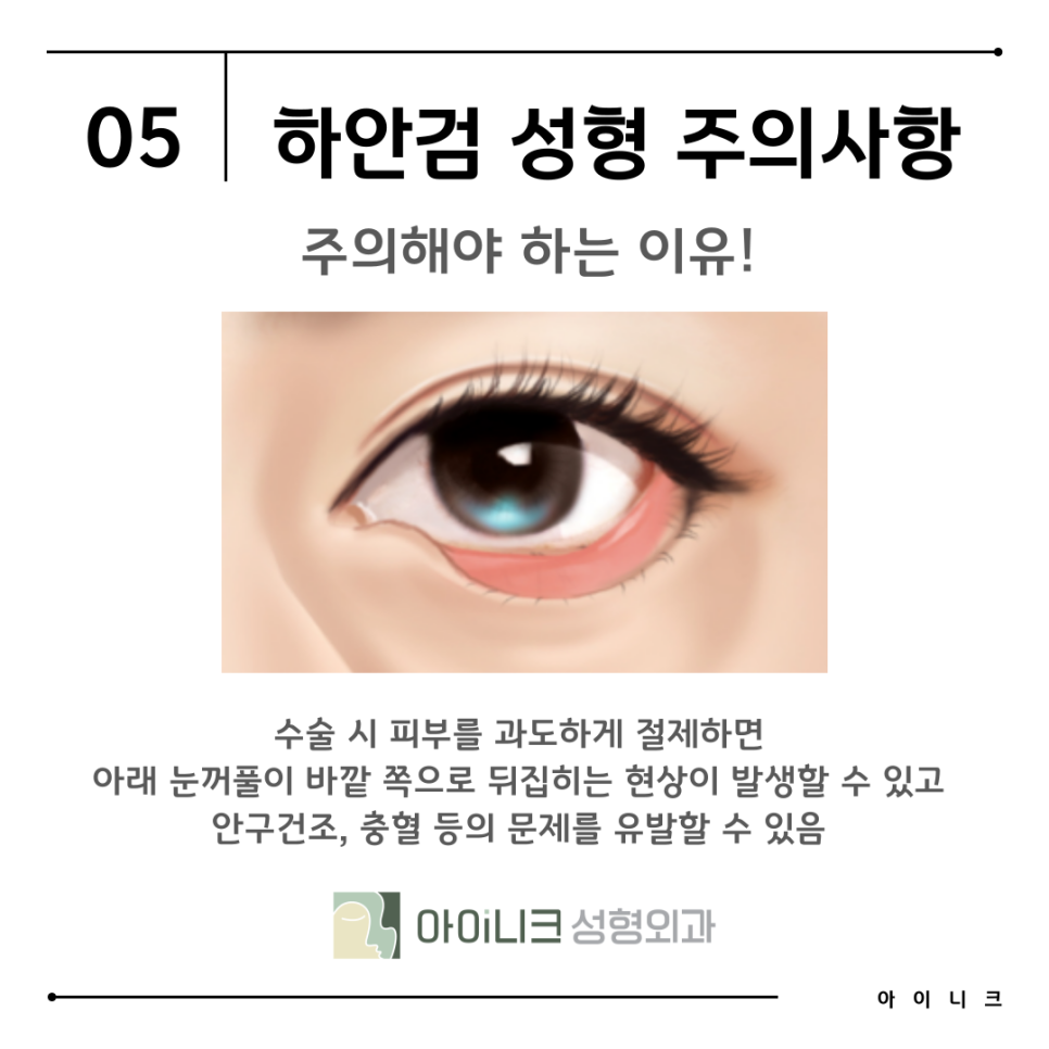 Recommended Hospital for Under-Eye Fat Repositioning: Finding the Right Method for Me image 12