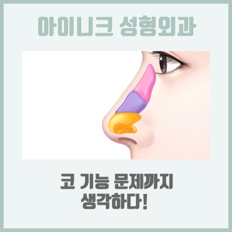화살코성형후기 정면, 측면 모두 완벽하게! 관련 이미지 4