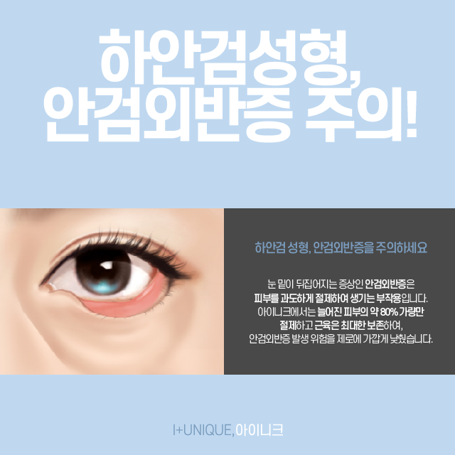 중년 눈 성형, 상안검성형술을 추천하지 않는 이유는? 관련 이미지 5