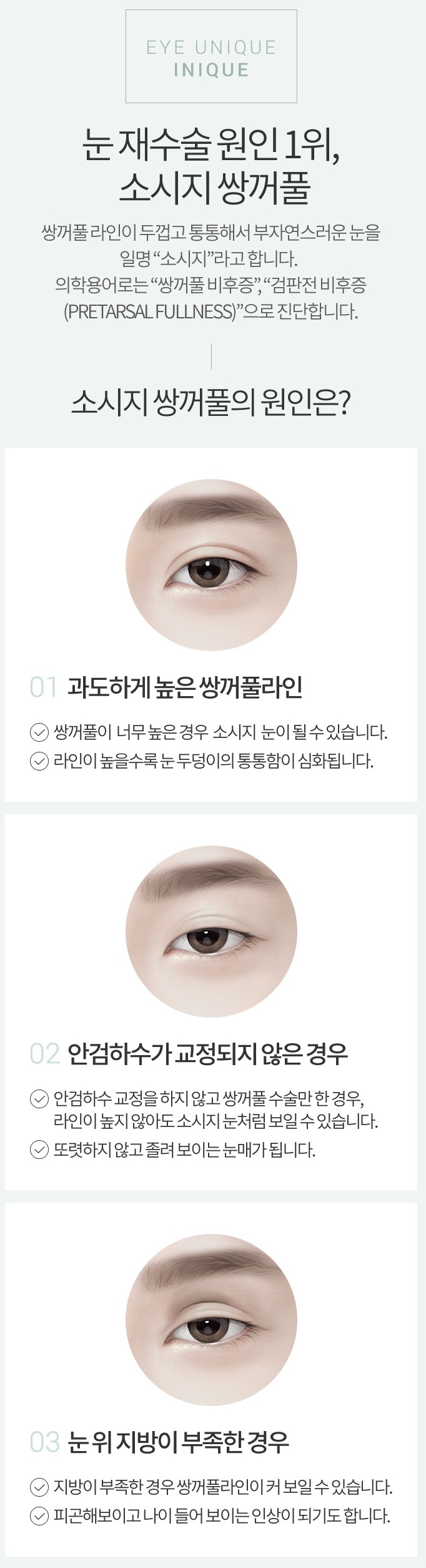 소시지쌍꺼풀 원인부터 파악하자! 관련 이미지 2