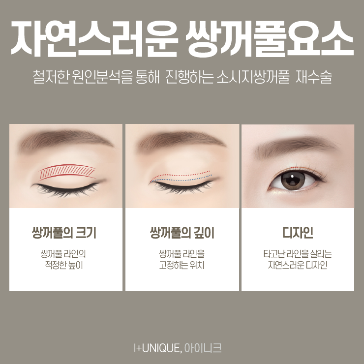 자연스러운쌍꺼풀을 원한다면 아이니크성형외과에서 이것만 확인하자 관련 이미지 3
