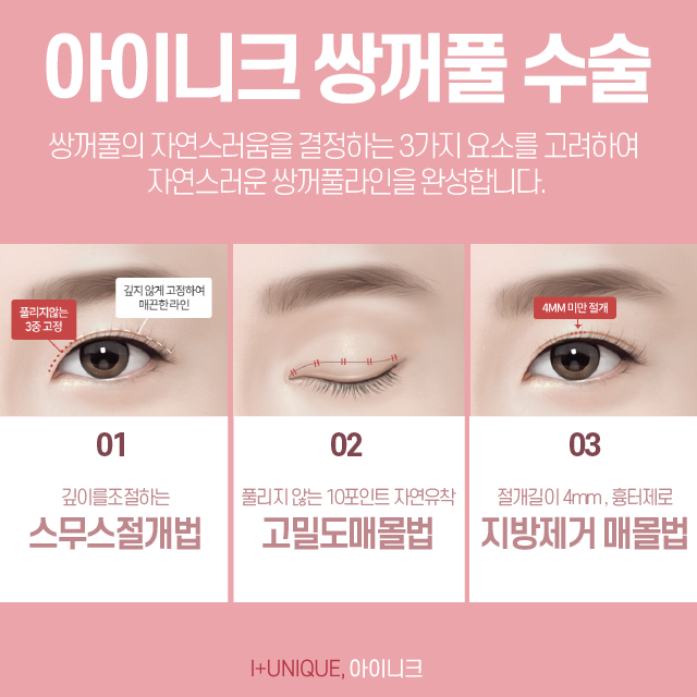 쌍수성형외과추천 받을 때 가장 중요한 것은 이것! 관련 이미지 3