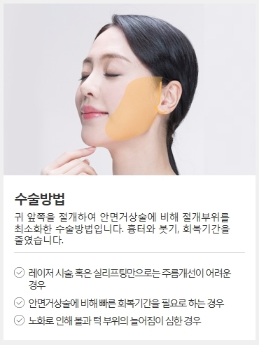 안면거상술회복기간이 걱정되나요? 관련 이미지 3