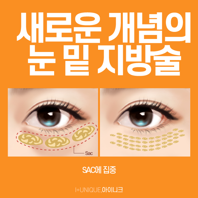 다크서클의 다양한 원인, 해결방안, 수술비용까지 한 번에 확인하자! 관련 이미지 3