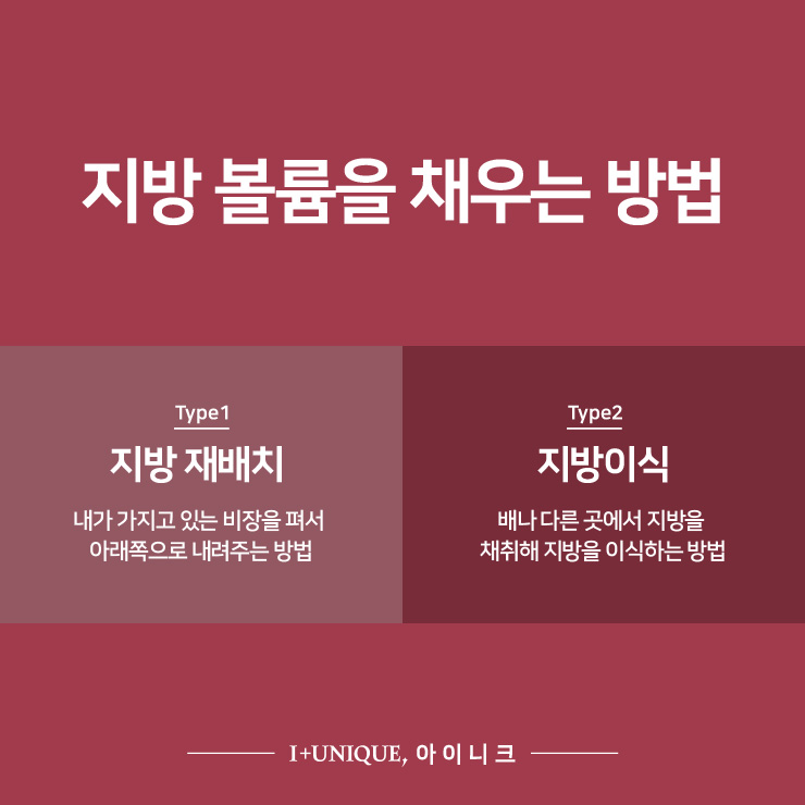 쌍꺼풀이 여러겹? 삼꺼풀 탈출하기 #2 관련 이미지 3