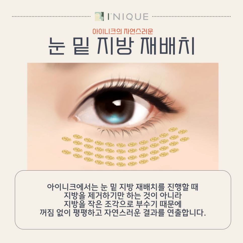 눈밑 주름 개선 방법 찾는다면 관련 이미지 5