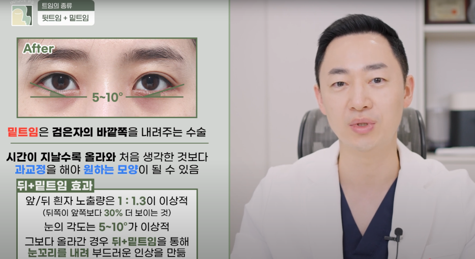 Upgraded with Apgujeong Eye Corner Surgery: Eyes That Look Twice as Large! image 8