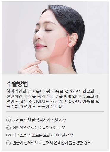 안면거상술회복기간이 걱정되나요? 관련 이미지 2