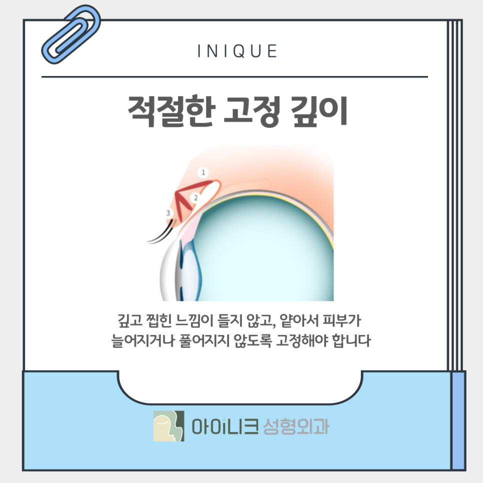 Double Eyelid Surgery: How Can You Create Clear, Beautiful Eyes? image 8