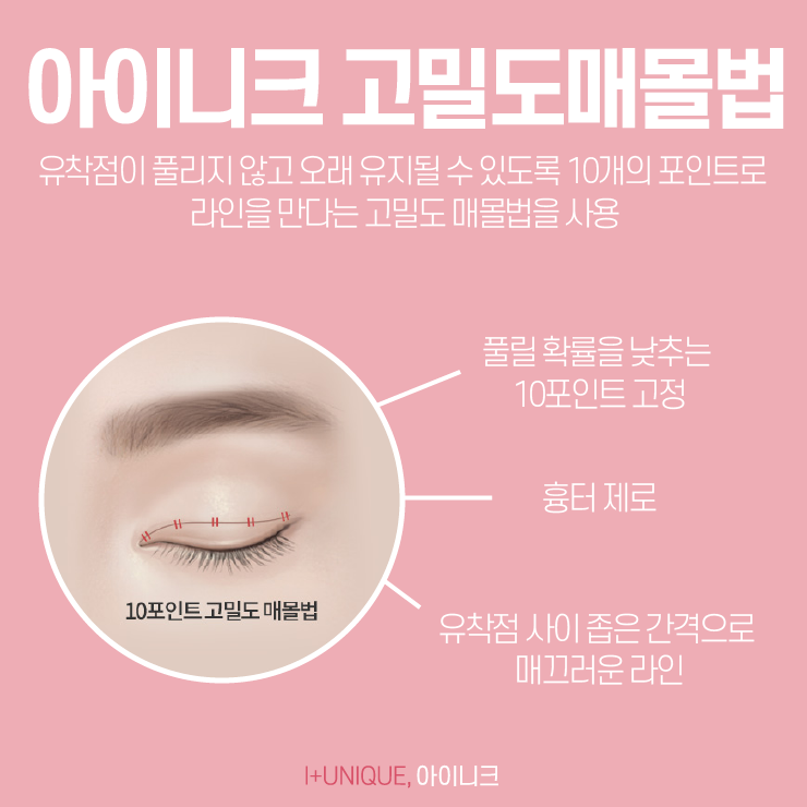 눈쌍커풀수술, 처음부터예뻤던 것처럼 아이니크성형외과에서 관련 이미지 5