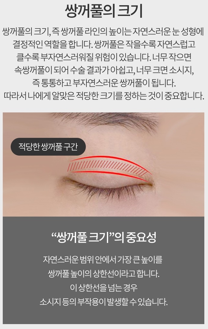 인아웃라인쌍꺼풀 예쁘고 자연스럽게 관련 이미지 4