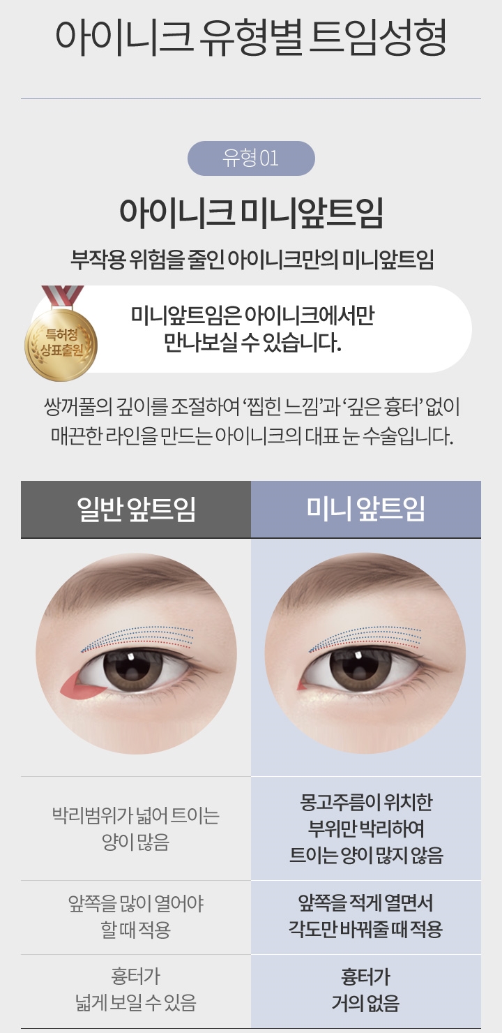 눈앞뒤트임 또렷한 눈매로 변신! 관련 이미지 4