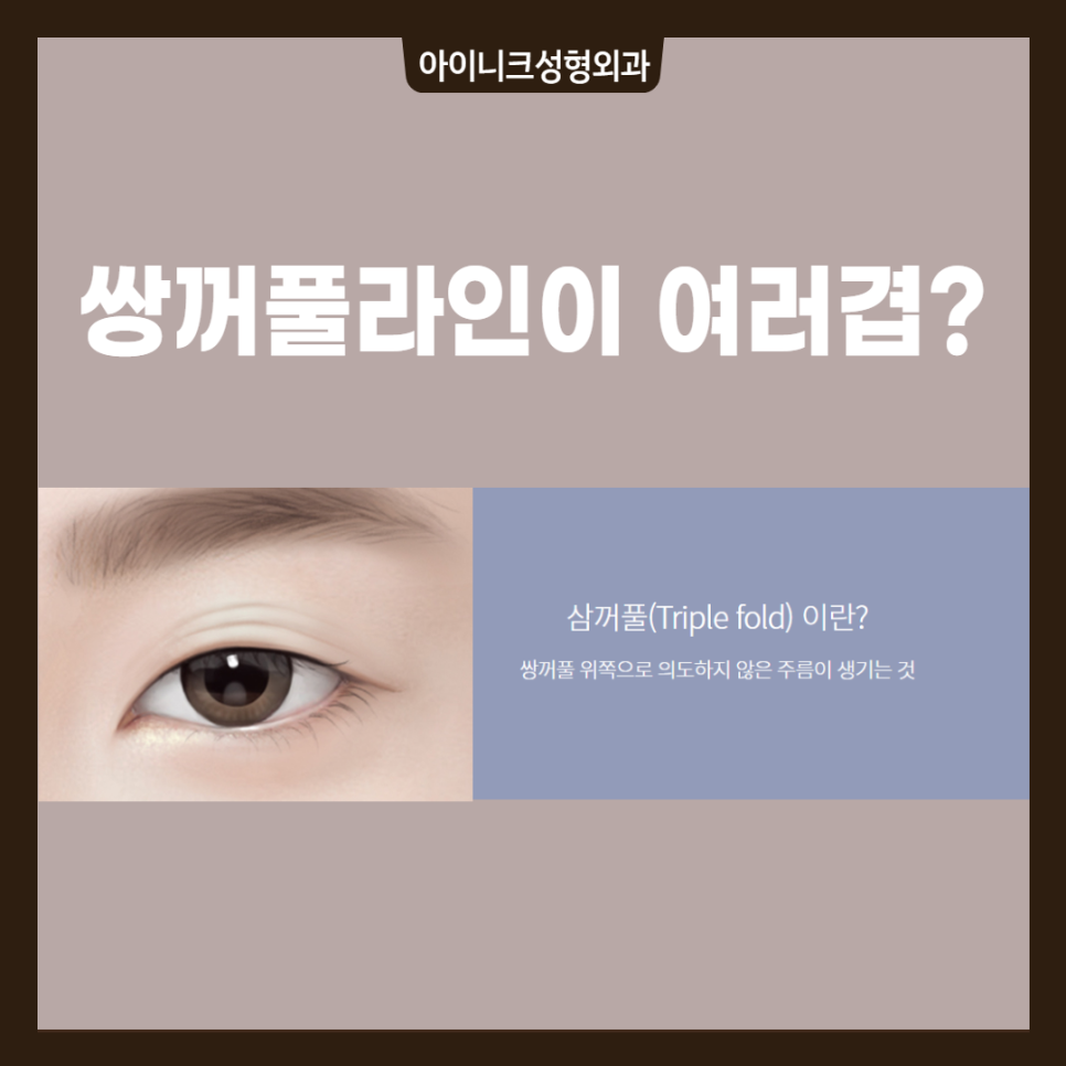 겹쌍꺼풀 해결방법, 원인에 따른 플랜이 필요해요! 관련 이미지 2