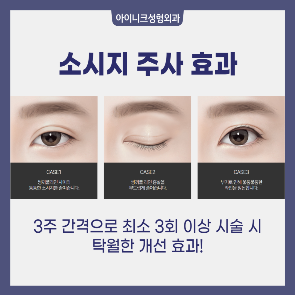 How to Reduce Double Eyelid Swelling Quickly, It’s Right Here! image 5