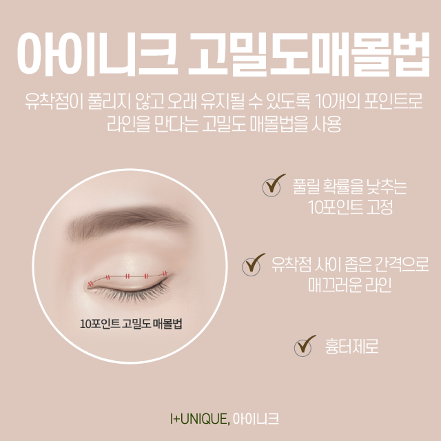 쌍꺼풀수술절개 그리고 매몰 부작용을 최소화하자. 관련 이미지 4