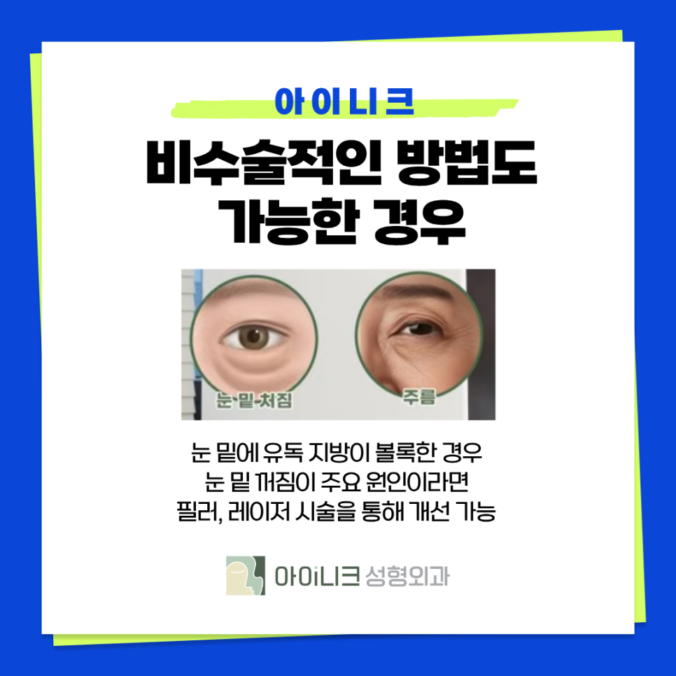비수술눈밑지방재배치 어떻게 다를까? 관련 이미지 3
