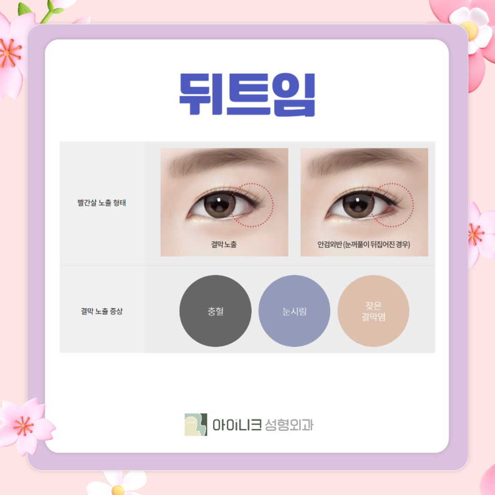 The Best Place for Women’s Eye Surgery Is Where I Had It Done image 4