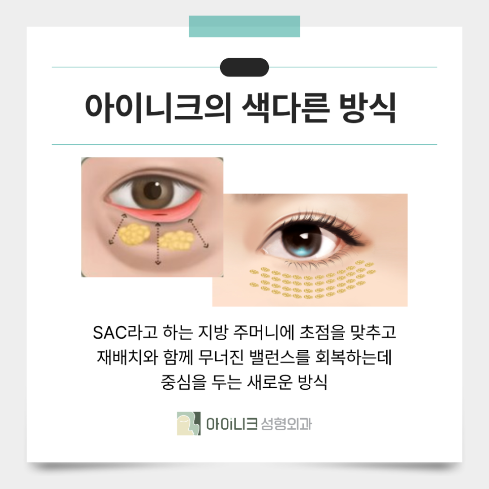 Under-Eye Fat Removal Laser: Eliminating Facial Shadows image 4