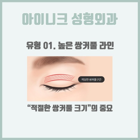 쌍커플재수술비용 원인별 맞춤 솔루션 제공! 관련 이미지 4
