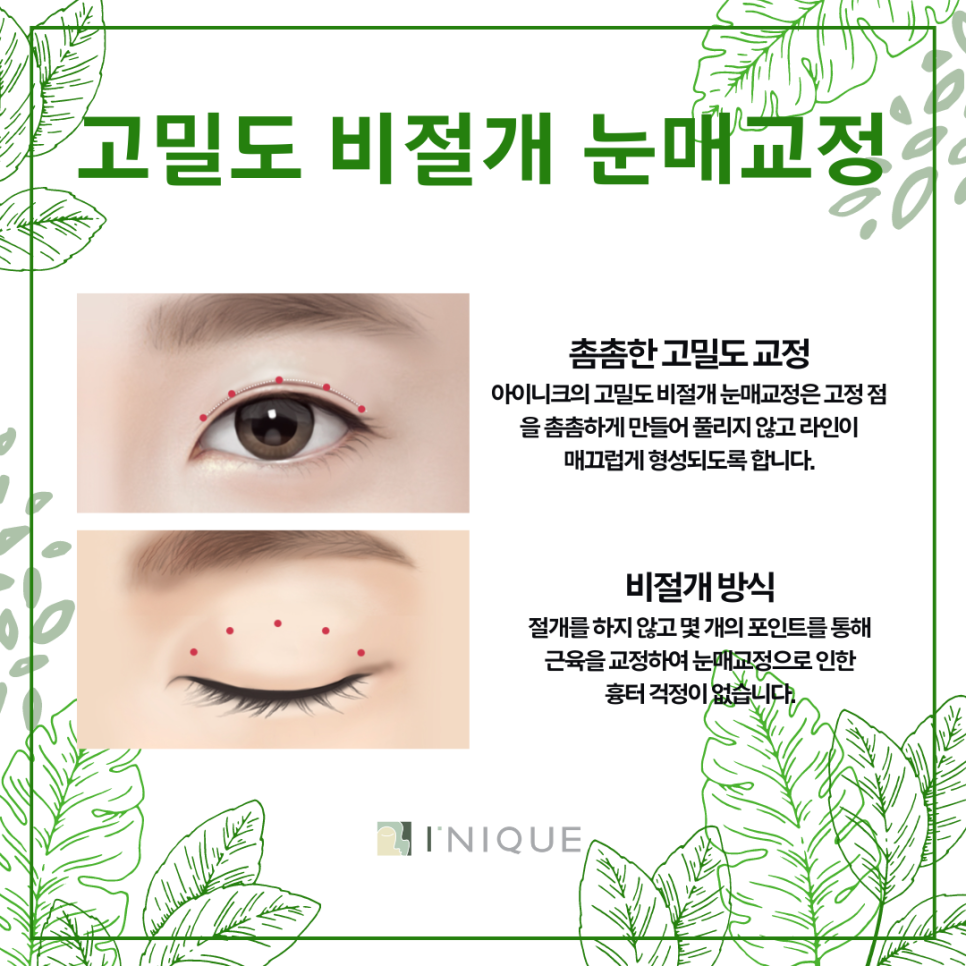 Droopy Eye Surgery, What Ptosis Means image 6