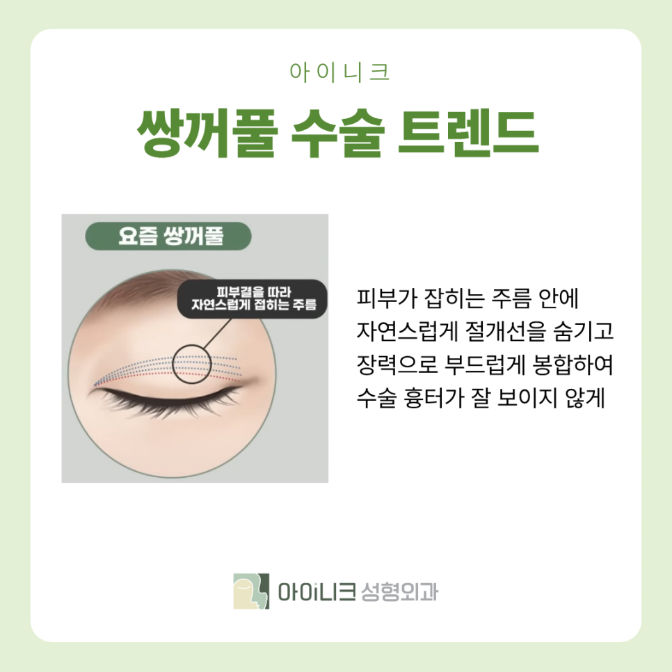 눈성형잘하는곳 2026 눈성형 트렌드는?? 관련 이미지 5