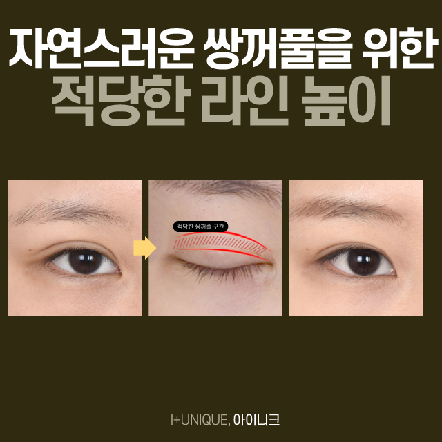 If you’re worried about side effects like double-eyelid surgery scars or a “sausage” look, I-NIQUE is the answer! image 3