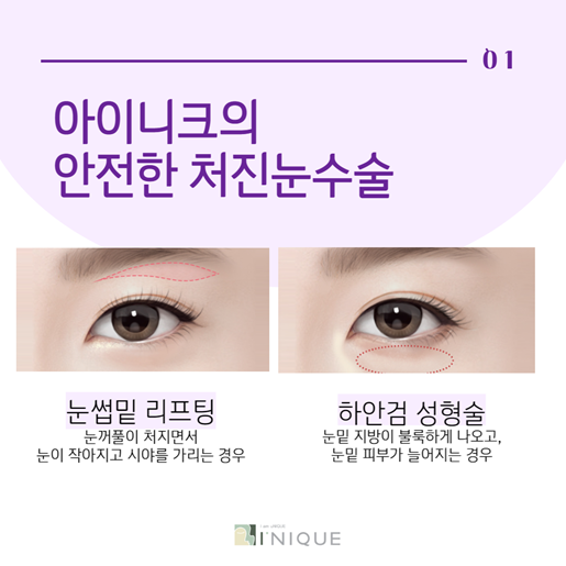 Restoring a Lively Eye Appearance with Drooping Eye Surgery image 2
