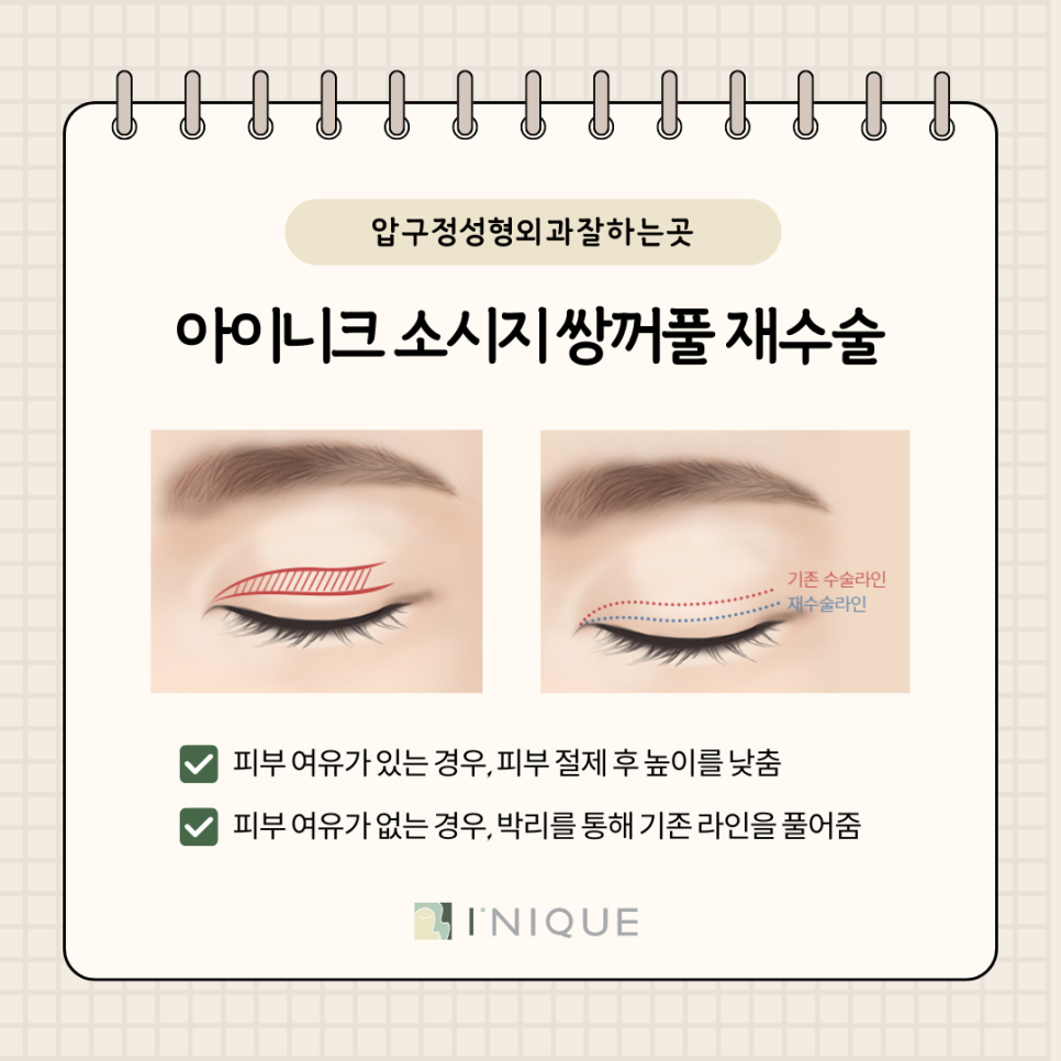 The Secret of Double Eyelid Height Revealed by a Best-Rated Apgujeong Plastic Surgery Clinic image 5