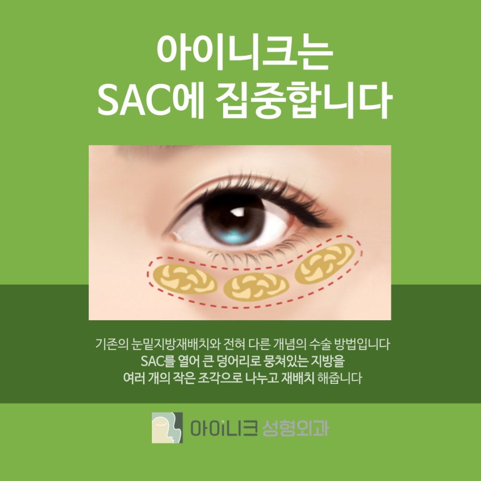 압구정역눈밑지방재배치 매끈하고 환한 눈매로! 관련 이미지 7