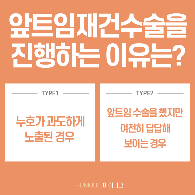 과교정으로 고생하고 있다면 아이니크의 앞트임재건수술로 해결! 관련 이미지 3